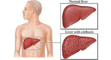 liver and bile duct cancer surgery